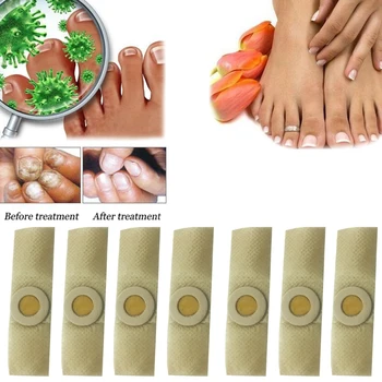 15BUC Chineză pe bază de Plante Unghiilor Fungice Tratament plasturi Anti Infecție Unghiilor Fungice Onicomicoza paronichie ciuperca piciorului patch nou