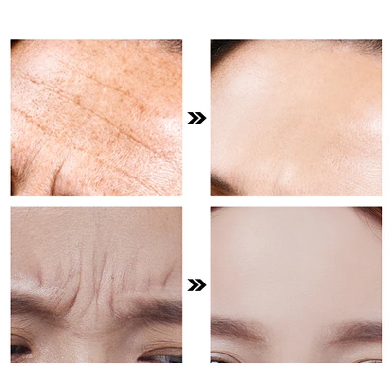 avantaj natural de îngrijire a pielii anti-îmbătrânire remedii de casă pentru tratamentul pielii anti-îmbătrânire