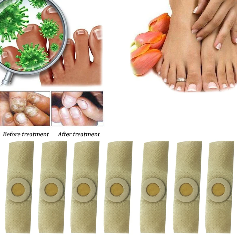 mâncărimea picioarelor de la ciuperca unghiilor medicament lichid pentru ciuperca unghiilor de la picioare